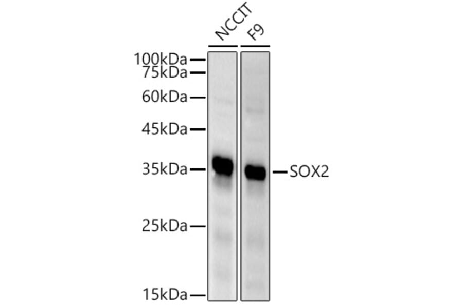 Western Blot - Anti-SOX2 Antibody (A81052) - Antibodies.com