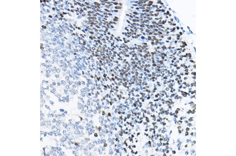 Immunohistochemistry - Anti-SOX2 Antibody (A81052) - Antibodies.com