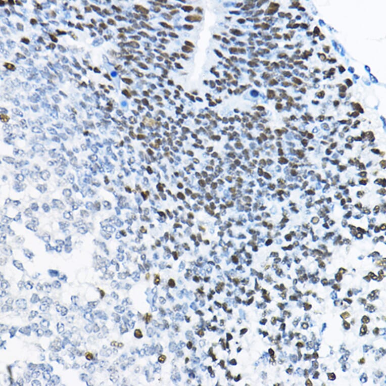 Immunohistochemistry - Anti-SOX2 Antibody (A81052) - Antibodies.com