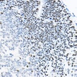 Immunohistochemistry - Anti-SOX2 Antibody (A81052) - Antibodies.com