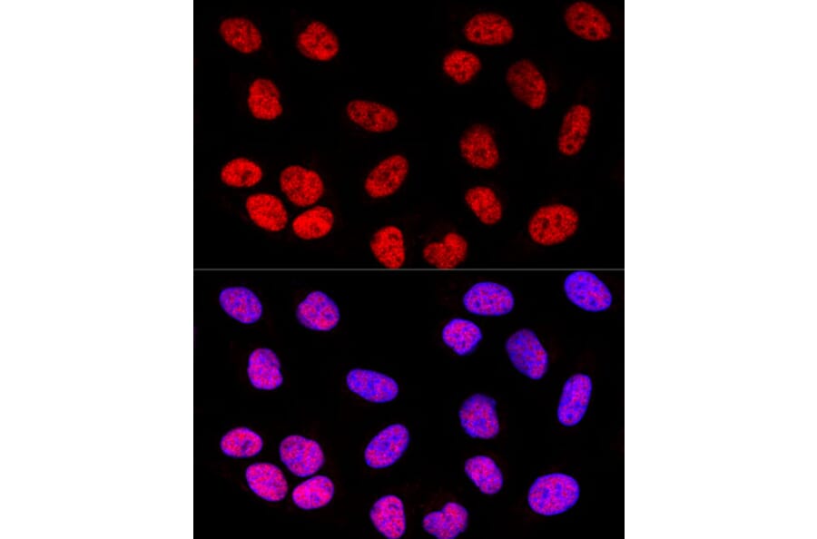 IHC analysis of U-2 OS cells