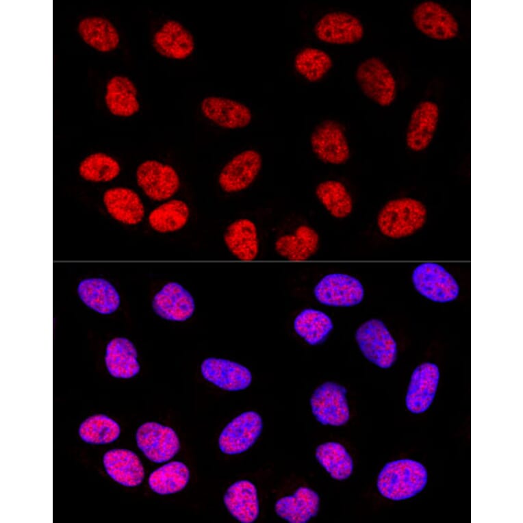 Immunofluorescence - Anti-SOX2 Antibody (A81052) - Antibodies.com