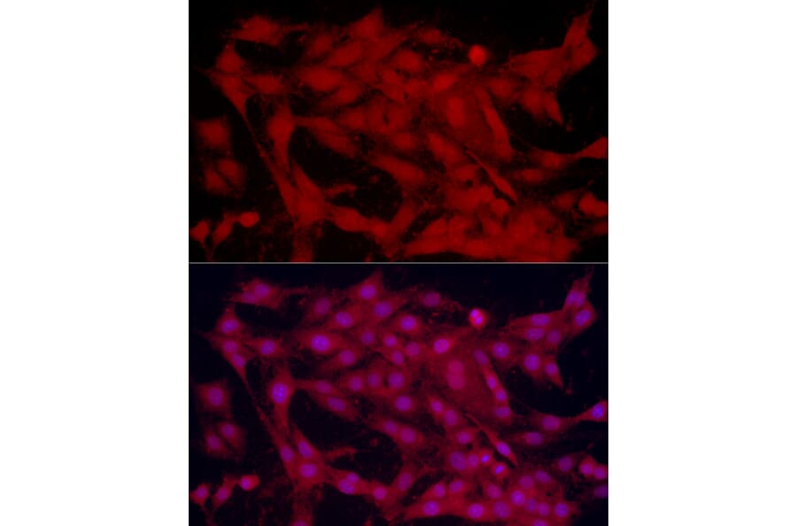 Immunofluorescence - Anti-SOX2 Antibody (A81052) - Antibodies.com