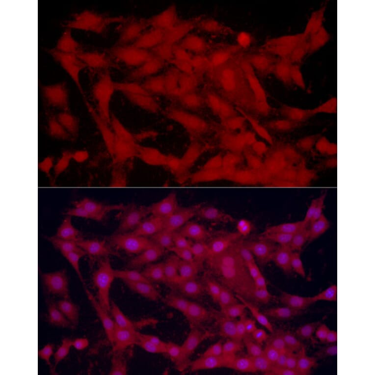 Immunofluorescence - Anti-SOX2 Antibody (A81052) - Antibodies.com