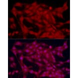 Immunofluorescence - Anti-SOX2 Antibody (A81052) - Antibodies.com