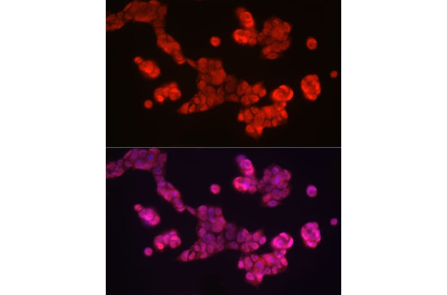 Immunofluorescence - Anti-SOX2 Antibody (A81052) - Antibodies.com