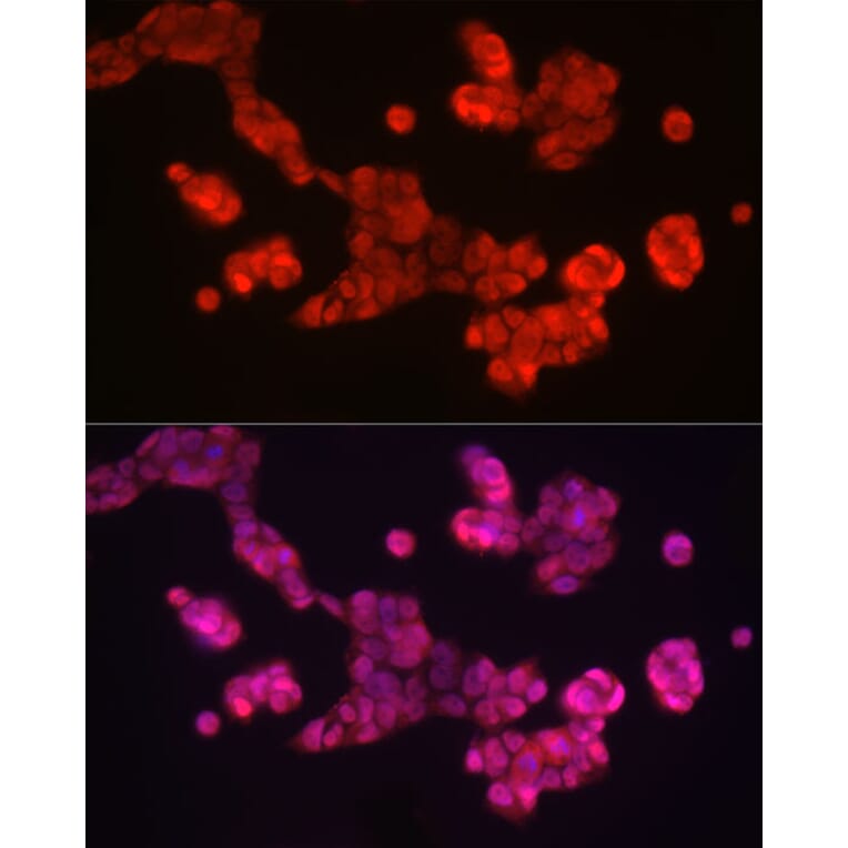 Immunofluorescence - Anti-SOX2 Antibody (A81052) - Antibodies.com