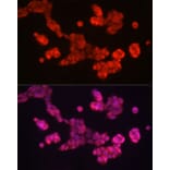 Immunofluorescence - Anti-SOX2 Antibody (A81052) - Antibodies.com