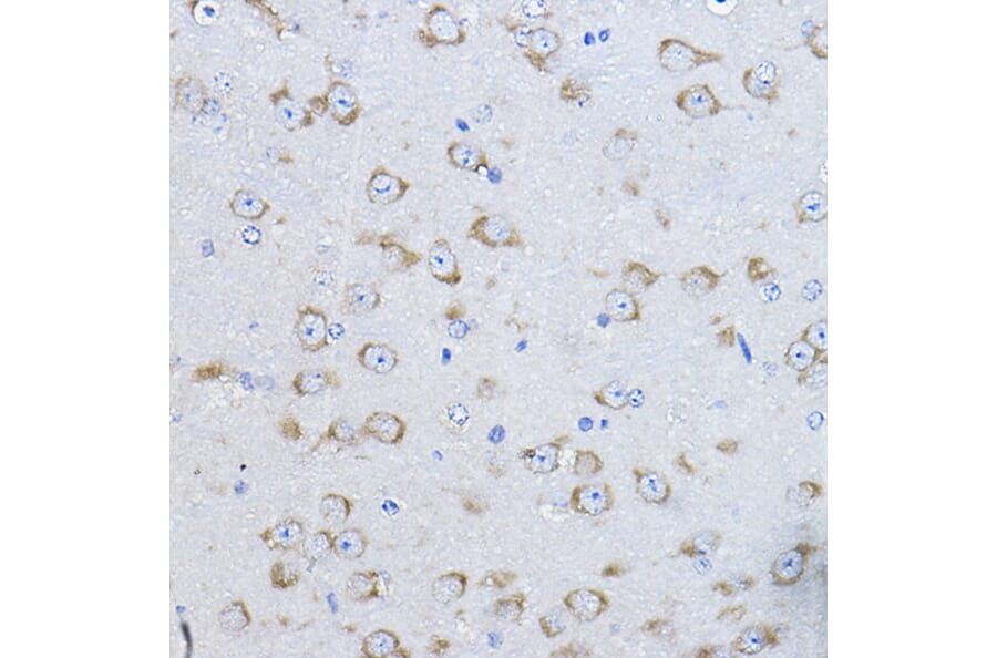 Immunohistochemistry - Anti-FAK Antibody (A81056) - Antibodies.com