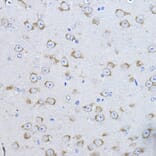 Immunohistochemistry - Anti-FAK Antibody (A81056) - Antibodies.com
