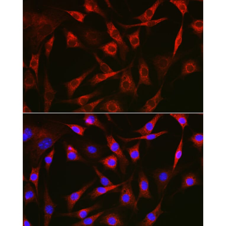 Immunofluorescence - Anti-FAK Antibody (A81056) - Antibodies.com