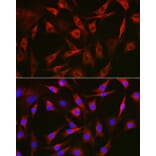 Immunofluorescence - Anti-FAK Antibody (A81056) - Antibodies.com