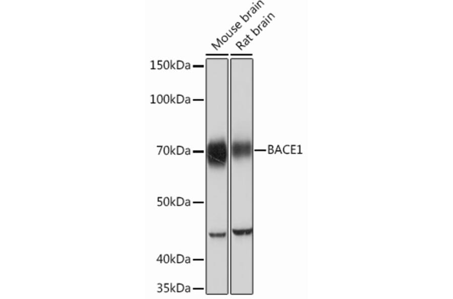 Western Blot - Anti-BACE1 Antibody [ARC0696] (A81057) - Antibodies.com