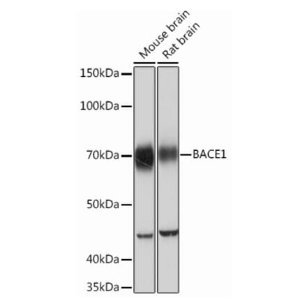 Western Blot - Anti-BACE1 Antibody [ARC0696] (A81057) - Antibodies.com