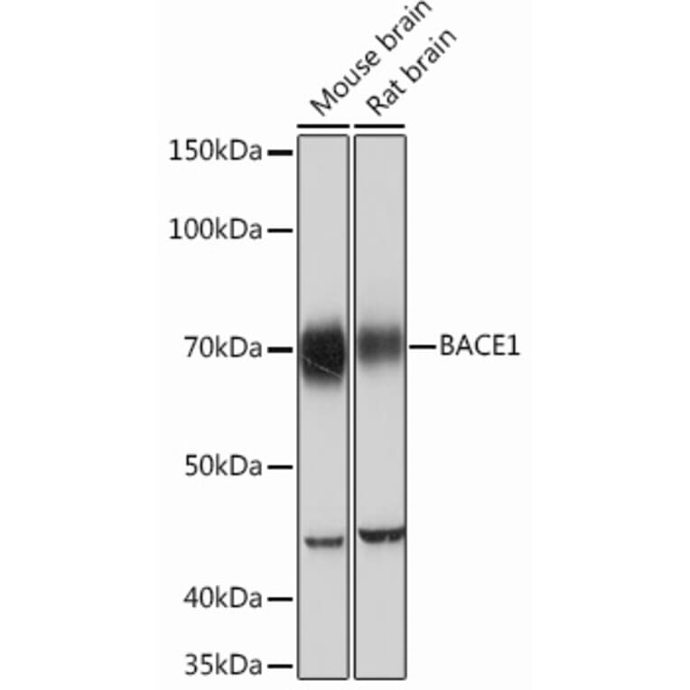 Western Blot - Anti-BACE1 Antibody [ARC0696] (A81057) - Antibodies.com