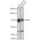 Western Blot - Anti-BACE1 Antibody [ARC0696] (A81057) - Antibodies.com