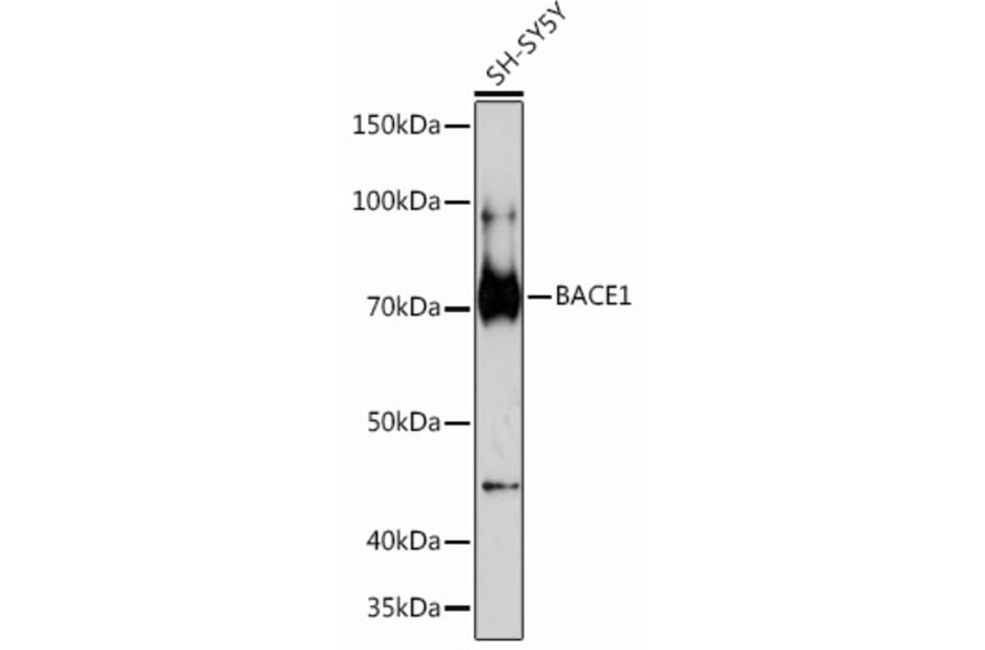 Western Blot - Anti-BACE1 Antibody [ARC0696] (A81057) - Antibodies.com