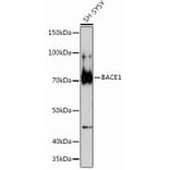 Western Blot - Anti-BACE1 Antibody [ARC0696] (A81057) - Antibodies.com