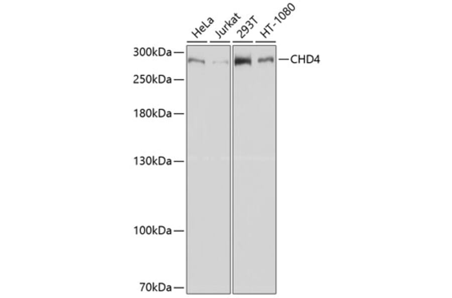 Western Blot - Anti-CHD4 Antibody (A81059) - Antibodies.com