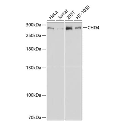 Western Blot - Anti-CHD4 Antibody (A81059) - Antibodies.com