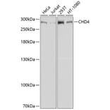 Western Blot - Anti-CHD4 Antibody (A81059) - Antibodies.com