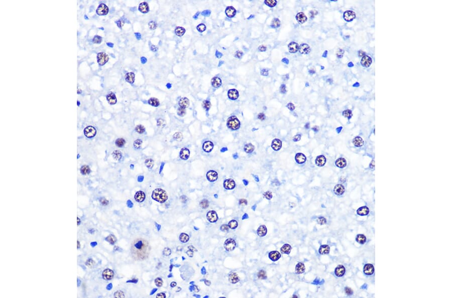Immunohistochemistry - Anti-CHD4 Antibody (A81059) - Antibodies.com