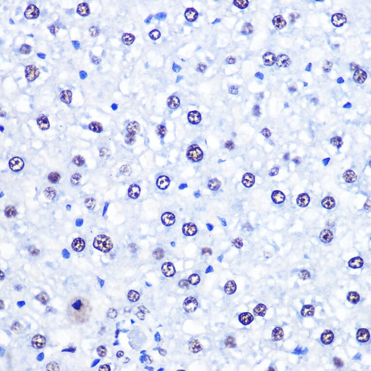 Immunohistochemistry - Anti-CHD4 Antibody (A81059) - Antibodies.com