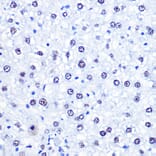 Immunohistochemistry - Anti-CHD4 Antibody (A81059) - Antibodies.com