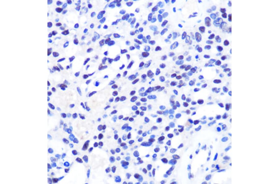 Immunohistochemistry - Anti-CHD4 Antibody (A81059) - Antibodies.com