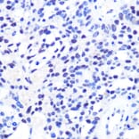 Immunohistochemistry - Anti-CHD4 Antibody (A81059) - Antibodies.com