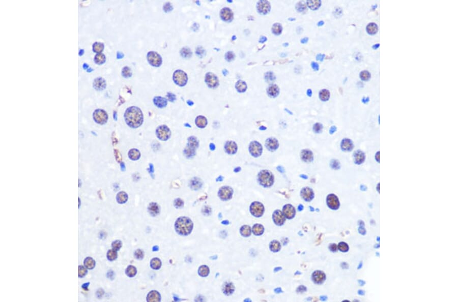 Immunohistochemistry - Anti-CHD4 Antibody (A81059) - Antibodies.com