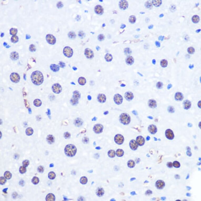 Immunohistochemistry - Anti-CHD4 Antibody (A81059) - Antibodies.com