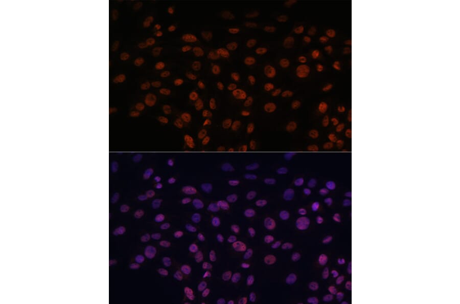 Immunofluorescence - Anti-CHD4 Antibody (A81059) - Antibodies.com
