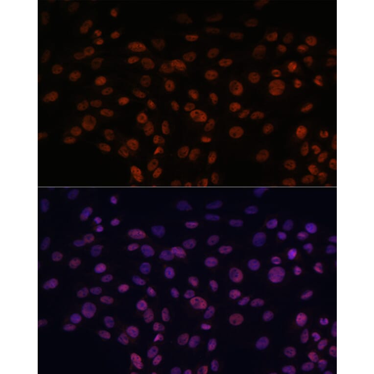 Immunofluorescence - Anti-CHD4 Antibody (A81059) - Antibodies.com