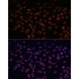 Immunofluorescence - Anti-CHD4 Antibody (A81059) - Antibodies.com