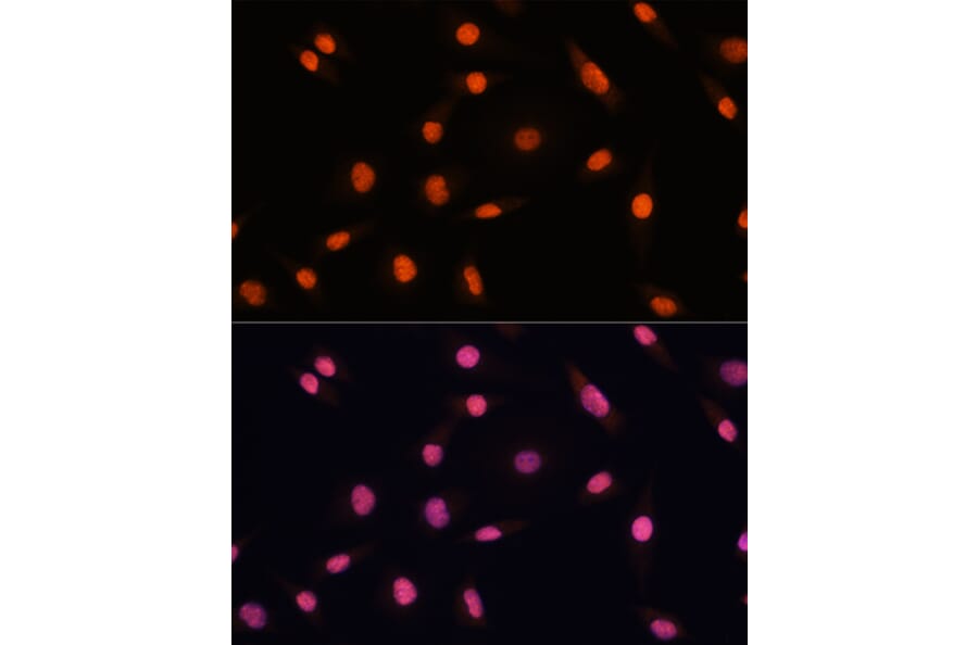 Immunofluorescence - Anti-CHD4 Antibody (A81059) - Antibodies.com