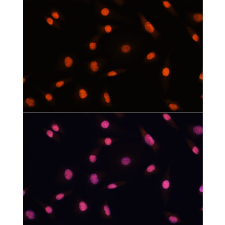 Immunofluorescence - Anti-CHD4 Antibody (A81059) - Antibodies.com