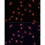 Immunofluorescence - Anti-CHD4 Antibody (A81059) - Antibodies.com