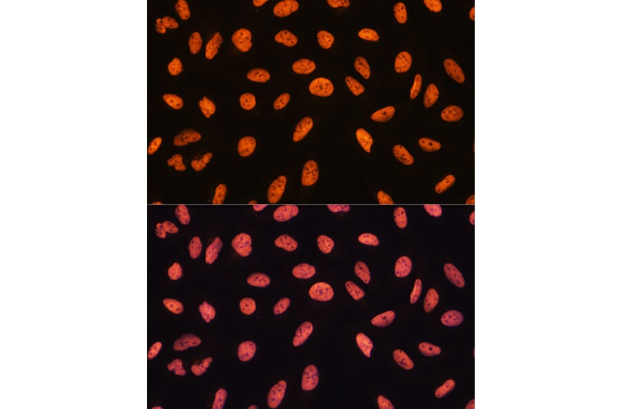Immunofluorescence - Anti-CHD4 Antibody (A81059) - Antibodies.com