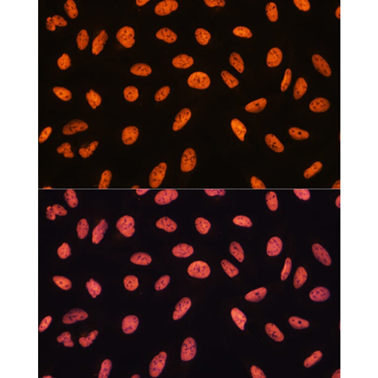 Immunofluorescence - Anti-CHD4 Antibody (A81059) - Antibodies.com