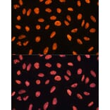 Immunofluorescence - Anti-CHD4 Antibody (A81059) - Antibodies.com
