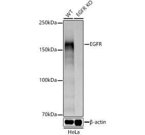 Western Blot - Anti-EGFR Antibody (A81060) - Antibodies.com