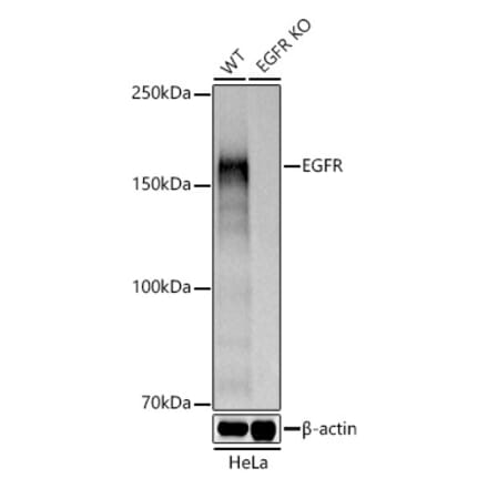 Western Blot - Anti-EGFR Antibody (A81060) - Antibodies.com