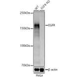 Western Blot - Anti-EGFR Antibody (A81060) - Antibodies.com