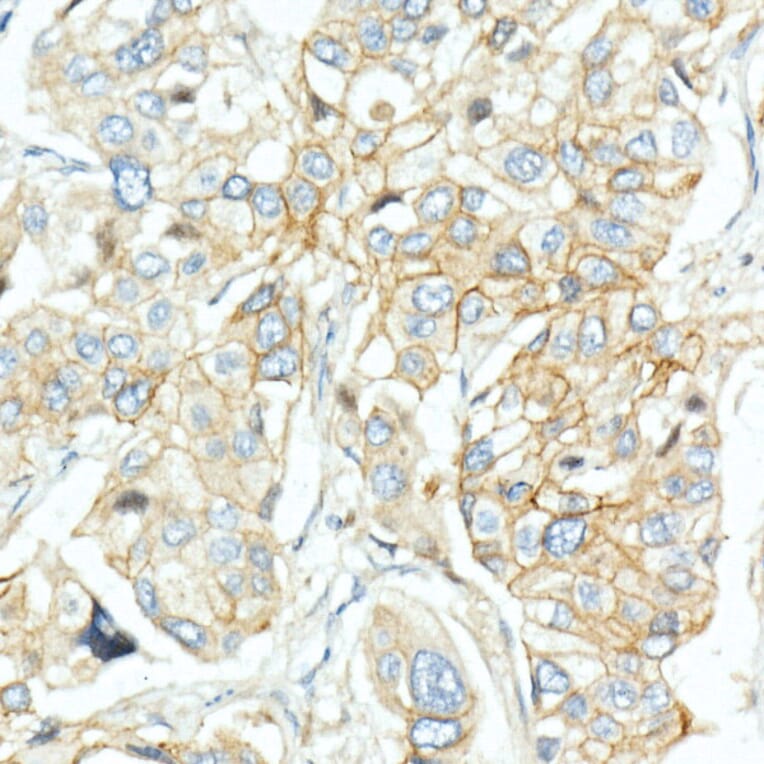 Immunohistochemistry - Anti-EGFR Antibody (A81060) - Antibodies.com