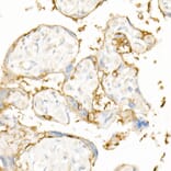 Immunohistochemistry - Anti-EGFR Antibody (A81060) - Antibodies.com