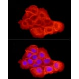 Immunofluorescence - Anti-EGFR Antibody (A81060) - Antibodies.com