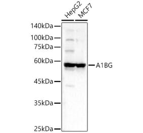 Western Blot - Anti-alpha 1B Glycoprotein Antibody (A81062) - Antibodies.com