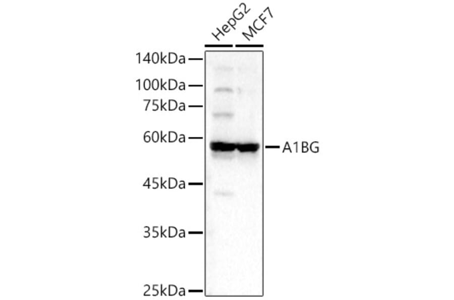 Western Blot - Anti-alpha 1B Glycoprotein Antibody (A81062) - Antibodies.com
