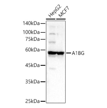 Western Blot - Anti-alpha 1B Glycoprotein Antibody (A81062) - Antibodies.com